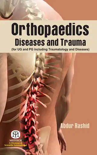 Cover Image of Orthopaedics Diseases and Trauma