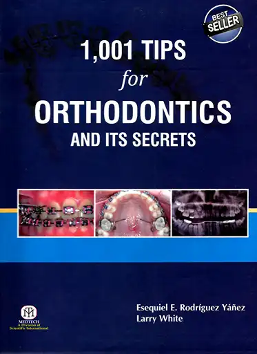 Cover Image of 1001 TIPS FOR ORTHODONTICS AND ITS SECRETS