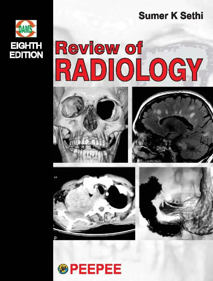Cover Image of Review of Radio-8
