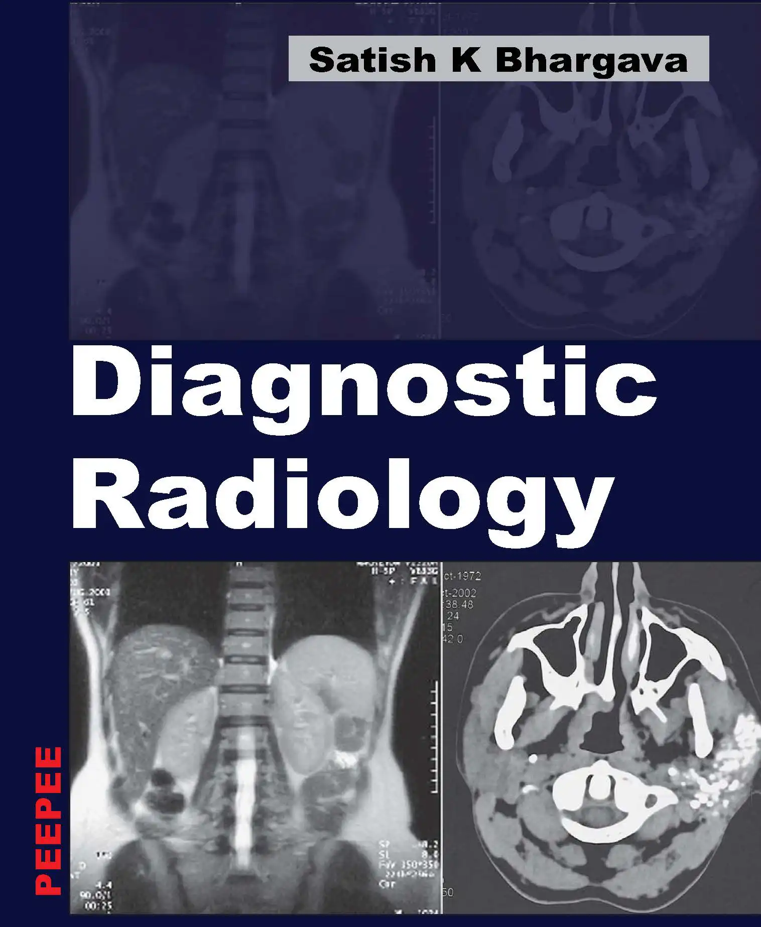Cover Image of Diagnostic Radiology